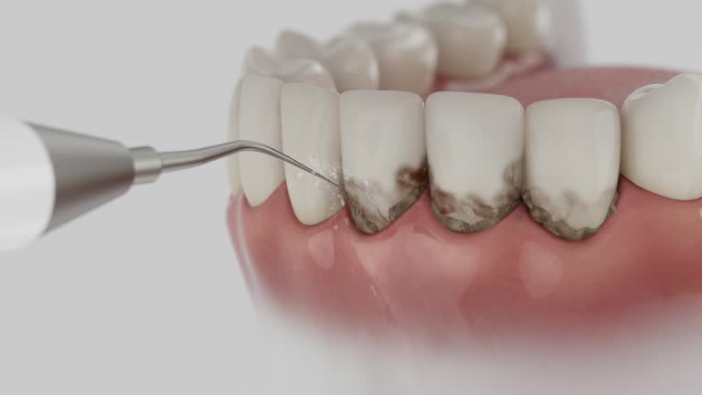 Reliable Dental contractor in Bermuda Dunes, CA by Dentist Open Now
